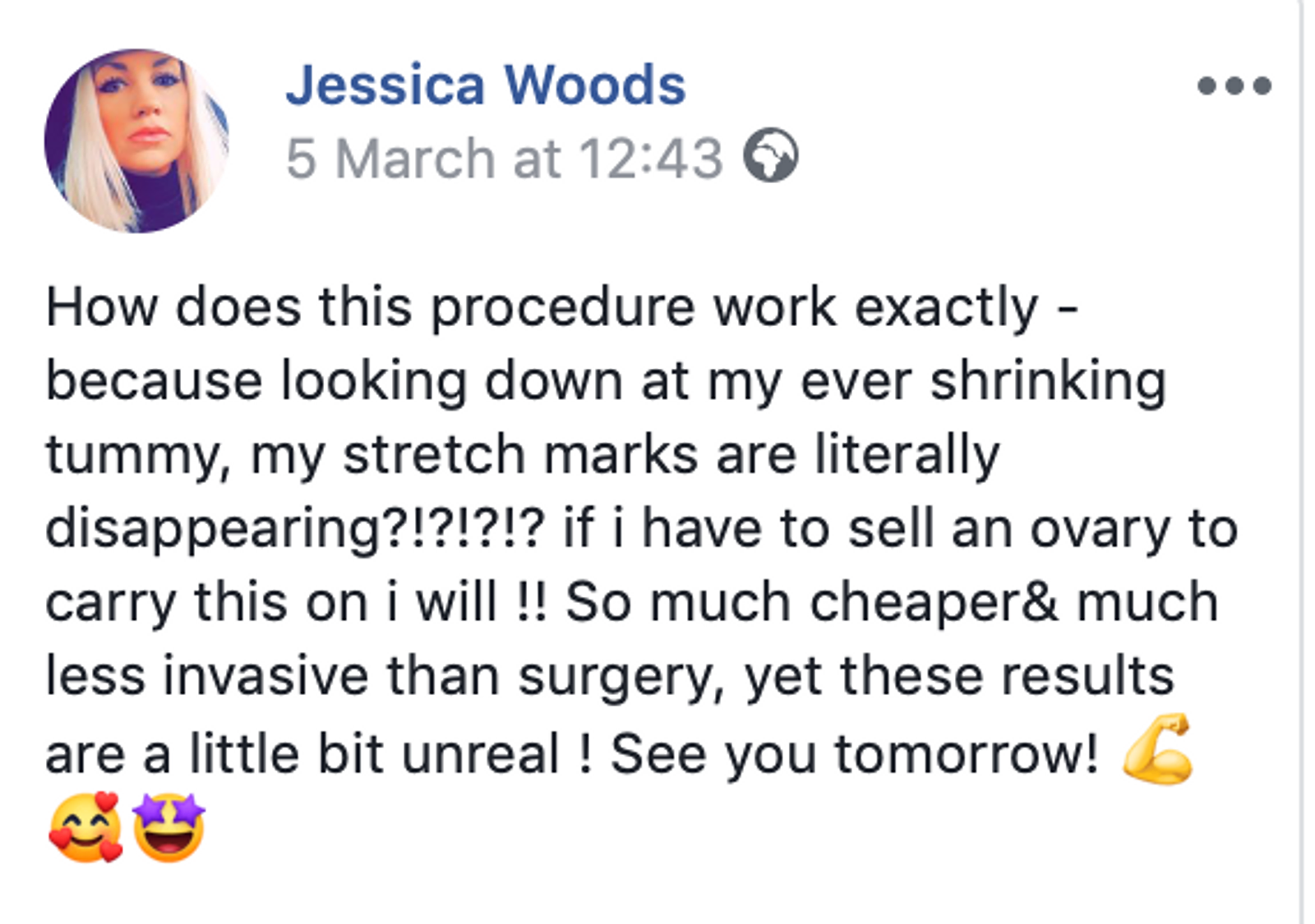 3d lipo review.png
